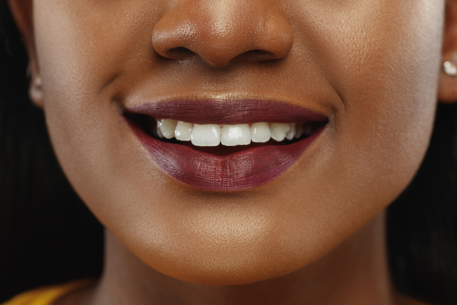 Natural teeth whitening Lagos