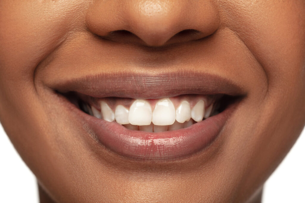 an image showing Health teeth